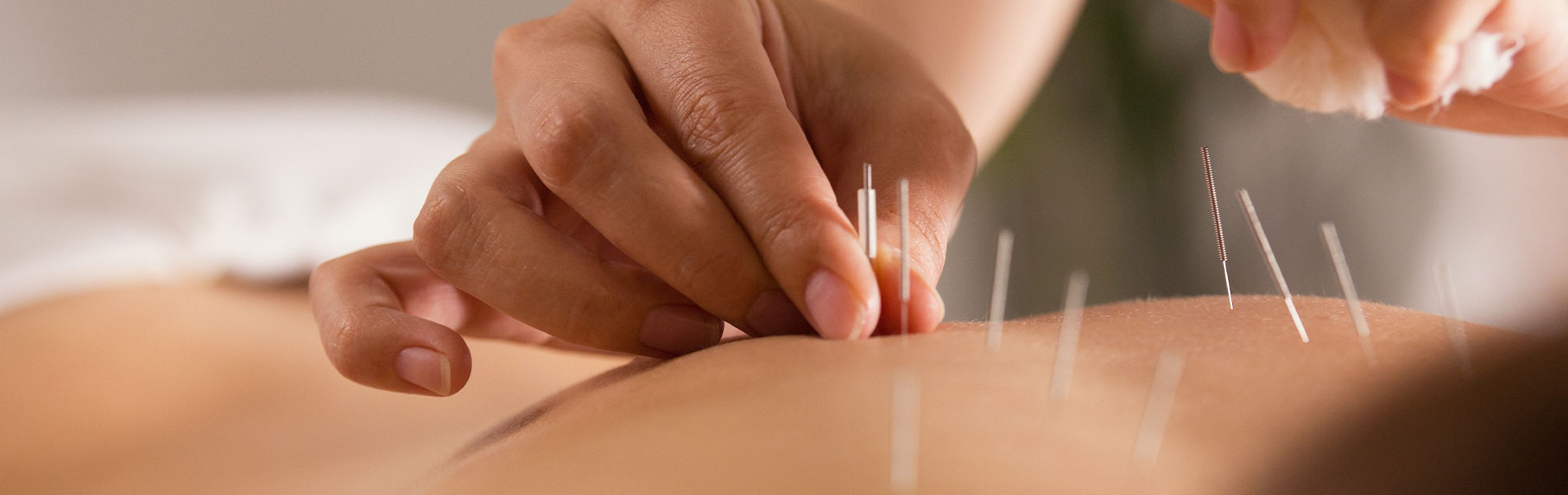slider-akupunktur